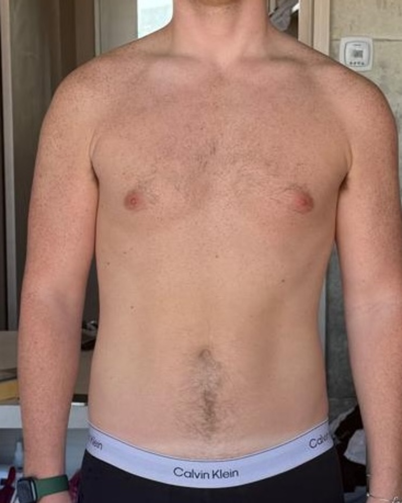 Before, week one